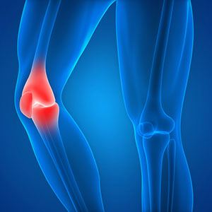 Knee Sports Injuries