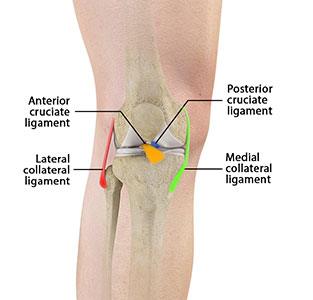 Multiligament Knee Injuries