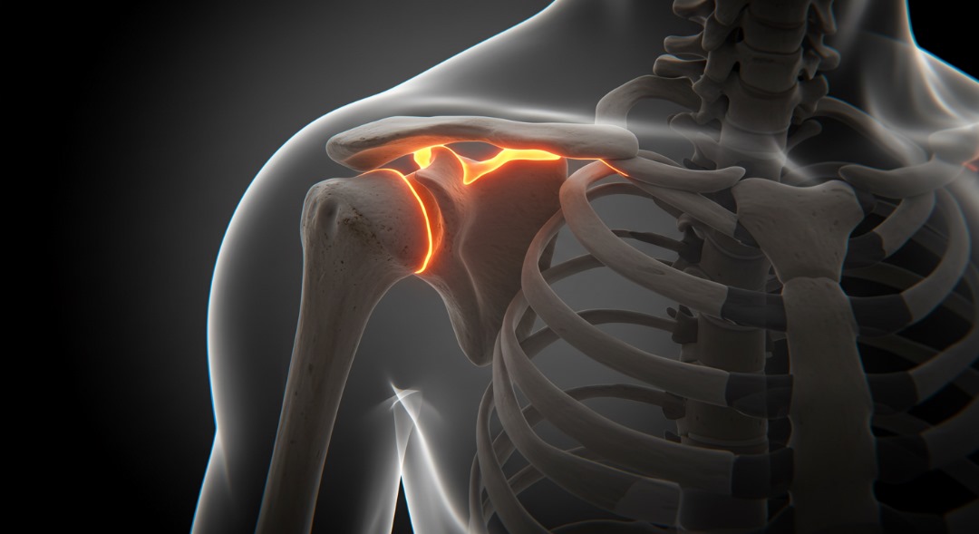 shoulder
